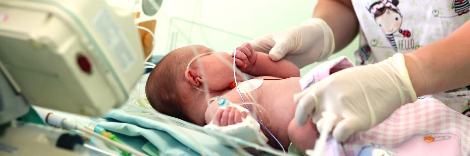 talking care baby in ICU