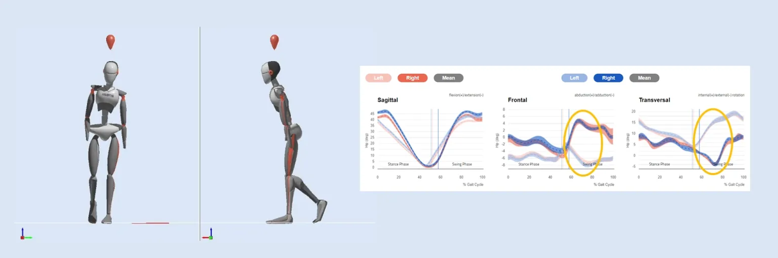 Gait Analysis-03