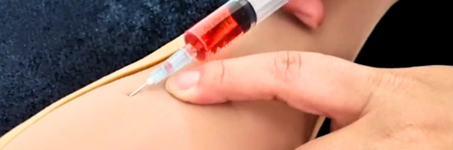 SINI injection-02